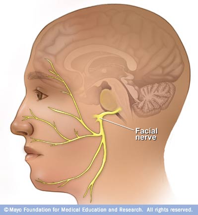 facial nerve damage